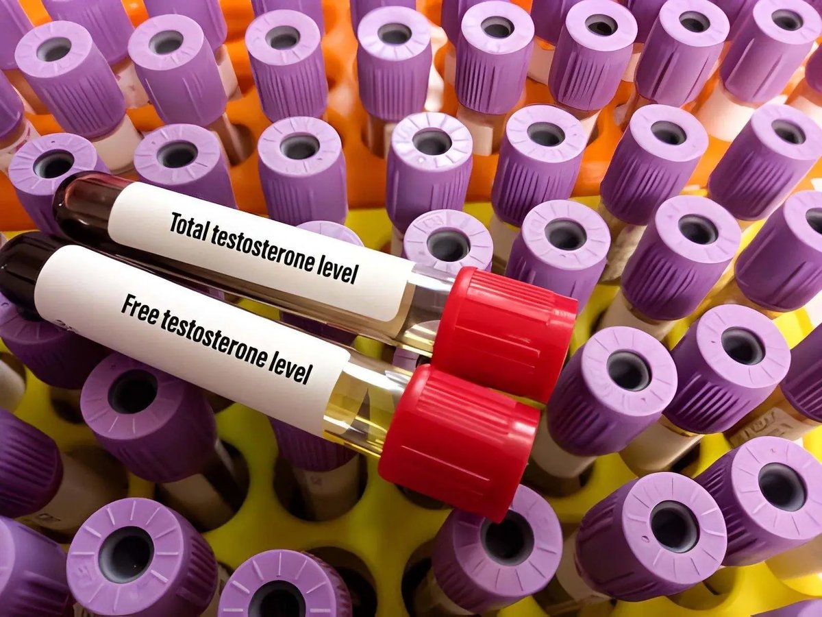 Blood sample tubes labeled total testosterone level and free testosterone level in a laboratory rack.