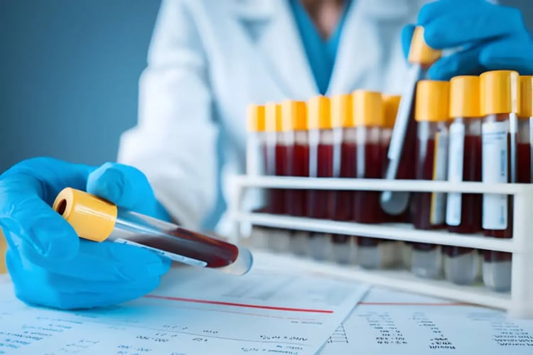 Laboratory technician handling blood samples for follow up bloodwork during TRT monitoring.
